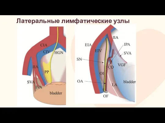 Латеральные лимфатические узлы