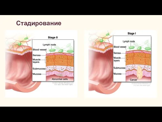 Стадирование