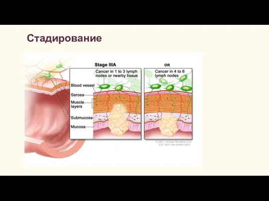 Стадирование