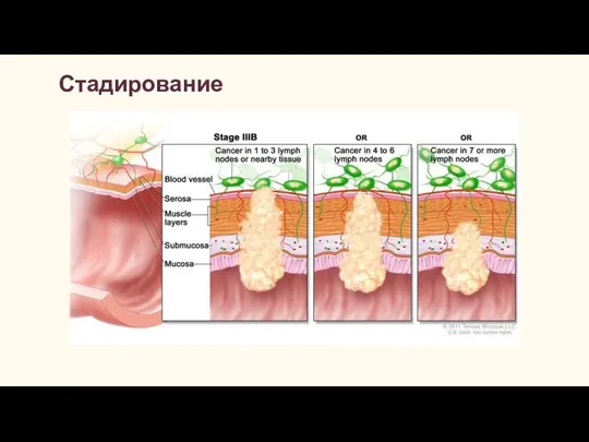 Стадирование