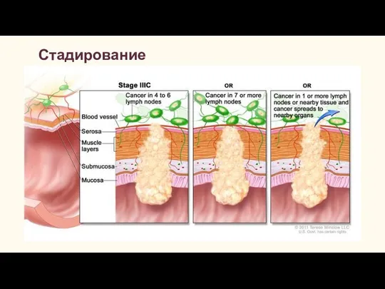 Стадирование