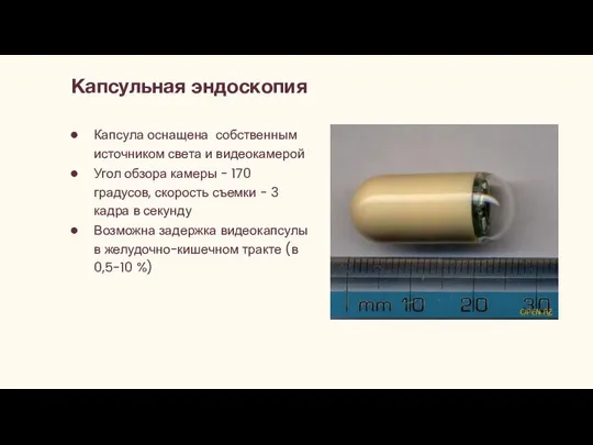 Капсульная эндоскопия Капсула оснащена собственным источником света и видеокамерой Угол обзора