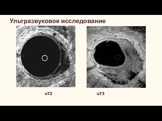 Ультразвуковое исследование uT2 uT3