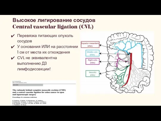 Перевязка питающих опухоль сосудов У основания ИЛИ на расстоянии 1 см