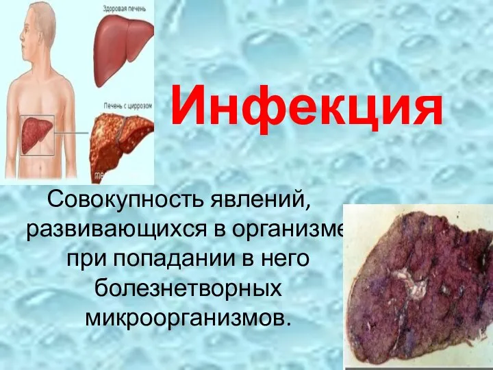 Инфекция Совокупность явлений, развивающихся в организме при попадании в него болезнетворных микроорганизмов.