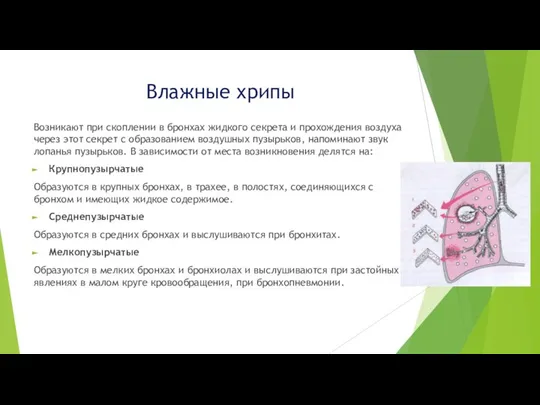 Влажные хрипы Возникают при скоплении в бронхах жидкого секрета и прохождения