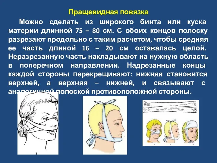 Пращевидная повязка Можно сделать из широкого бинта или куска материи длинной