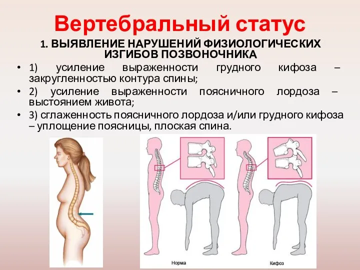 Вертебральный статус 1. ВЫЯВЛЕНИЕ НАРУШЕНИЙ ФИЗИОЛОГИЧЕСКИХ ИЗГИБОВ ПОЗВОНОЧНИКА 1) усиление выраженности