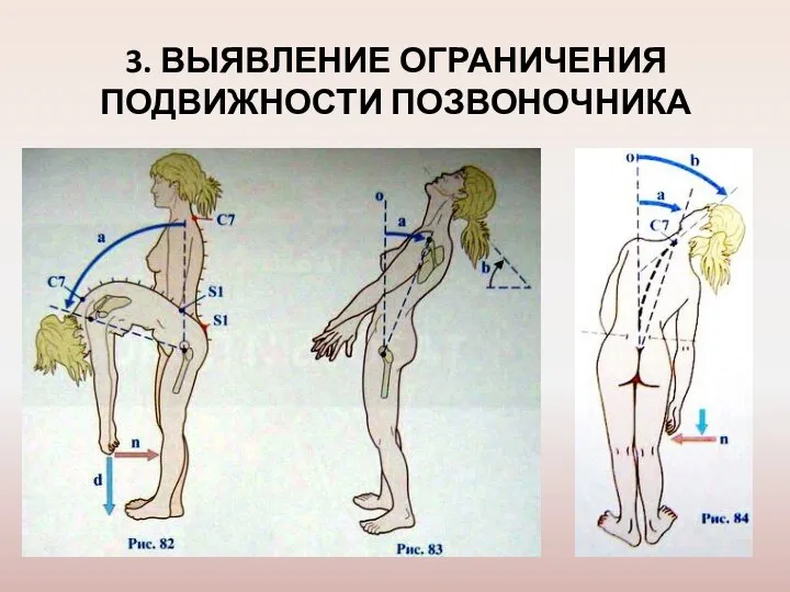 3. ВЫЯВЛЕНИЕ ОГРАНИЧЕНИЯ ПОДВИЖНОСТИ ПОЗВОНОЧНИКА