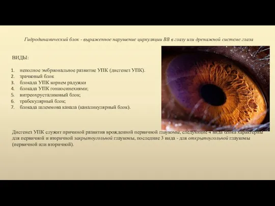 Гидродинамический блок - выраженное нарушение циркуляции ВВ в глазу или дренажной