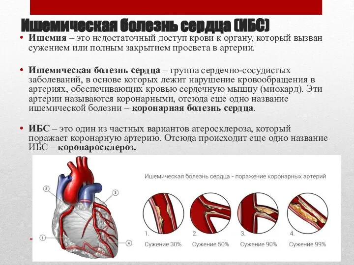 Ишемическая болезнь сердца (ИБС) Ишемия – это недостаточный доступ крови к