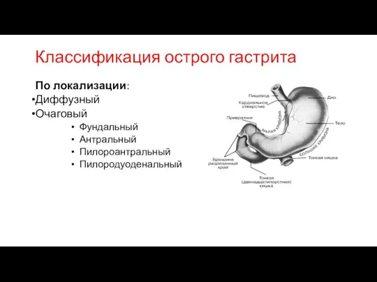 Классификация острого гастрита По локализации: Диффузный Очаговый Фундальный Антральный Пилороантральный Пилородуоденальный