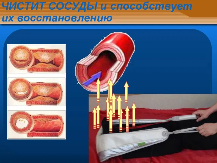 ЧИСТИТ СОСУДЫ и способствует их восстановлению