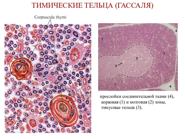 ТИМИЧЕСКИЕ ТЕЛЬЦА (ГАССАЛЯ) прослойки соединительной ткани (4), корковая (1) и мозговая (2) зоны, тимусные тельца (3).