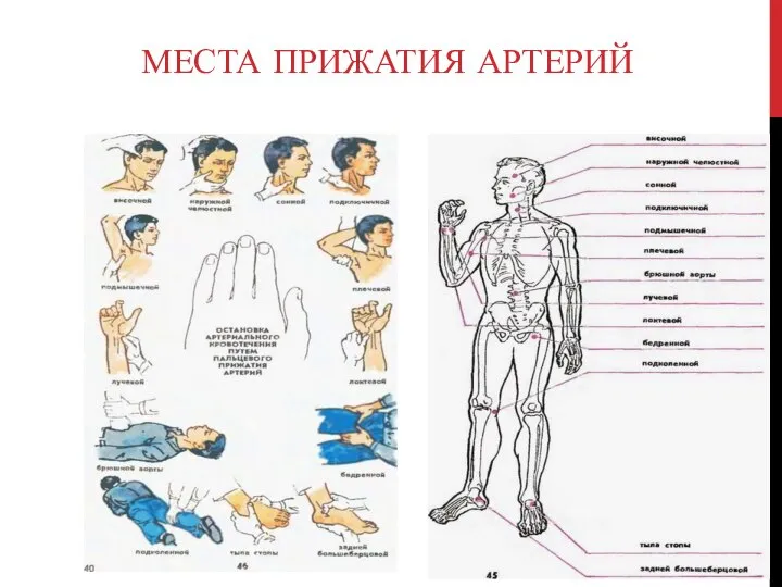 МЕСТА ПРИЖАТИЯ АРТЕРИЙ