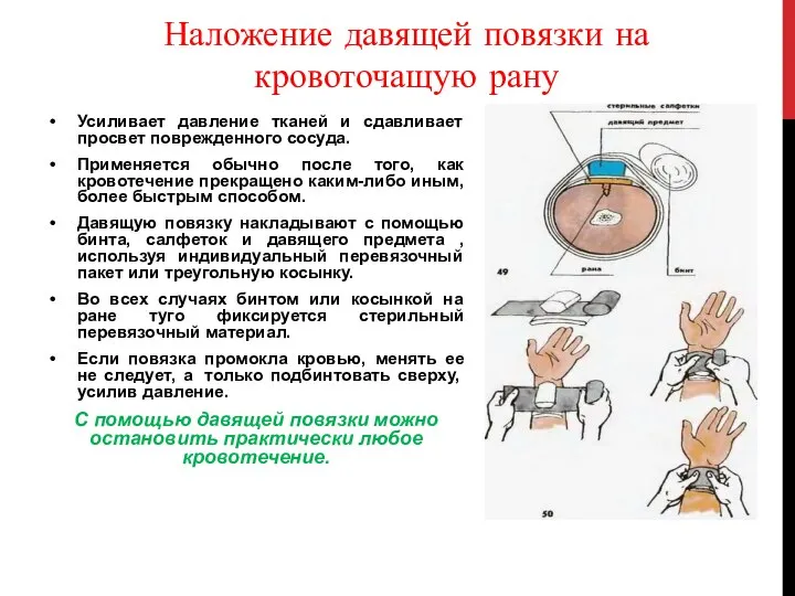 Наложение давящей повязки на кровоточащую рану Усиливает давление тканей и сдавливает