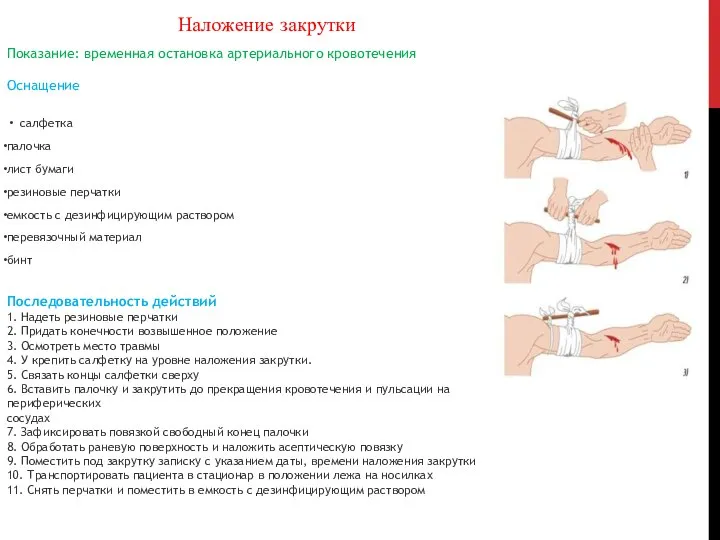 Наложение закрутки Показание: временная остановка артериального кровотечения Оснащение салфетка палочка лист