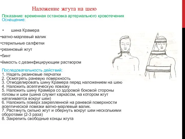 Наложение жгута на шею Показание: временная остановка артериального кровотечения Оснащение: шина