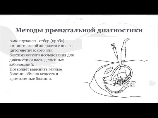 Методы пренатальной диагностики Амниоцентоз - отбор (проба) амниотической жидкости с целью