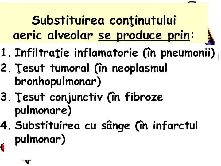 Substituirea conţinutului aeric alveolar se produce prin: Infiltraţie inflamatorie (în pneumonii)