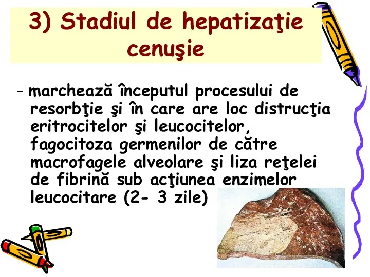 3) Stadiul de hepatizaţie cenuşie - marchează începutul procesului de resorbţie