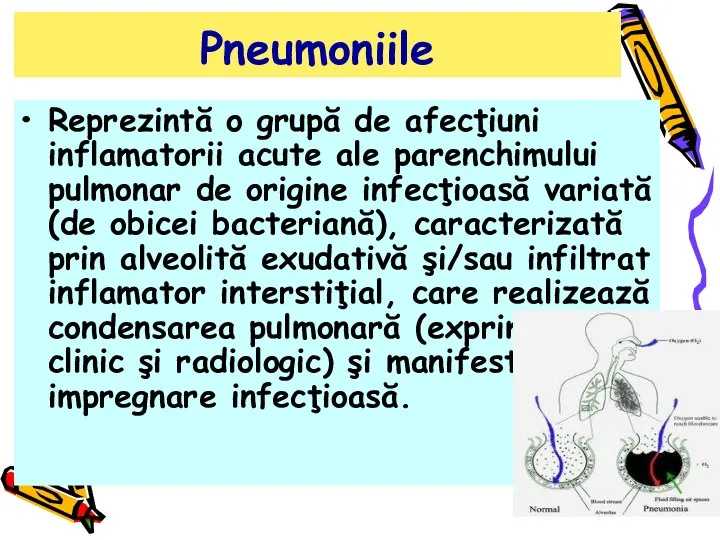 Pneumoniile Reprezintă o grupă de afecţiuni inflamatorii acute ale parenchimului pulmonar