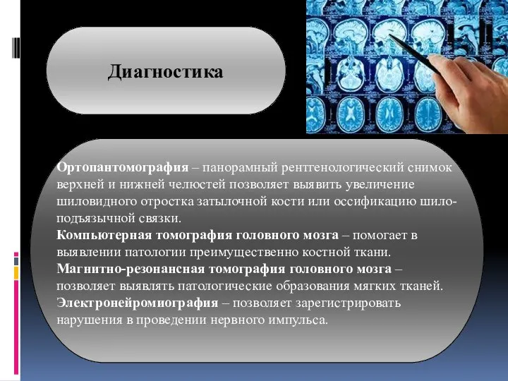 Ортопантомография – панорамный рентгенологический снимок верхней и нижней челюстей позволяет выявить