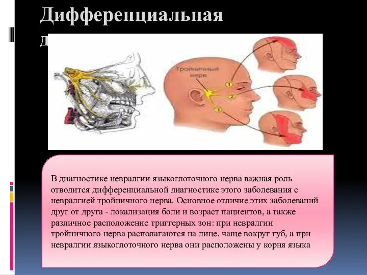 Дифференциальная диагностика В диагностике невралгии языкоглоточного нерва важная роль отводится дифференциальной