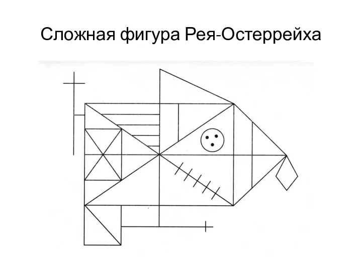 Сложная фигура Рея-Остеррейха