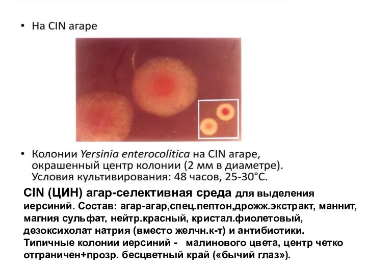 CIN (ЦИН) агар-селективная среда для выделения иерсиний. Состав: агар-агар,спец.пептон,дрожж.экстракт, маннит, магния