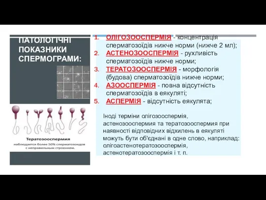 ПАТОЛОГІЧНІ ПОКАЗНИКИ СПЕРМОГРАМИ: ОЛІГОЗООСПЕРМІЯ - концентрація сперматозоїдів нижче норми (нижче 2