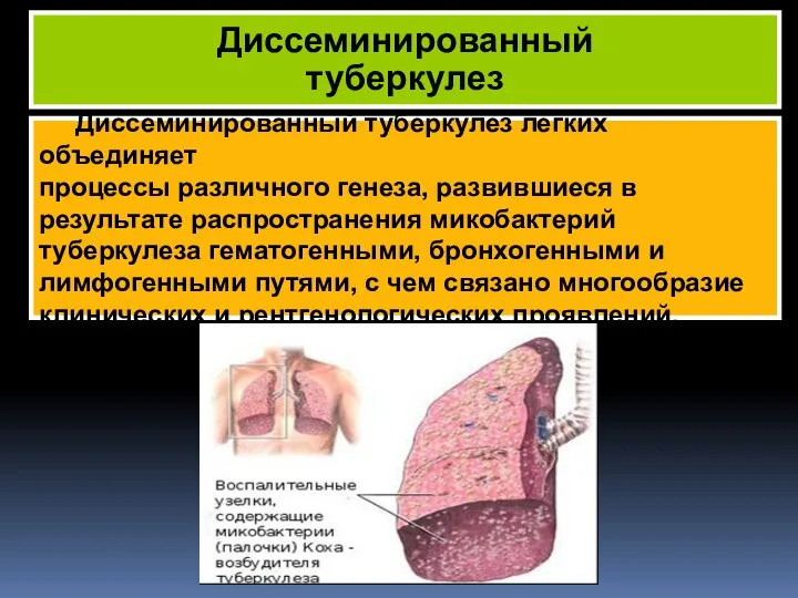 Диссеминированный туберкулез легких объединяет процессы различного генеза, развившиеся в результате распространения