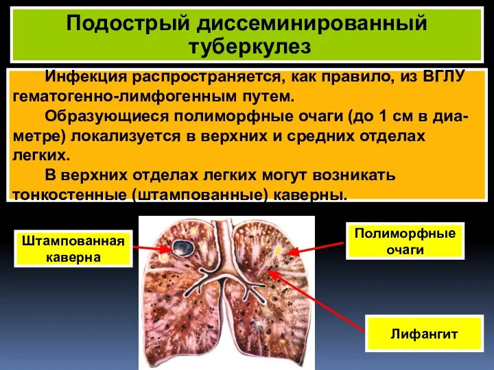 Инфекция распространяется, как правило, из ВГЛУ гематогенно-лимфогенным путем. Образующиеся полиморфные очаги