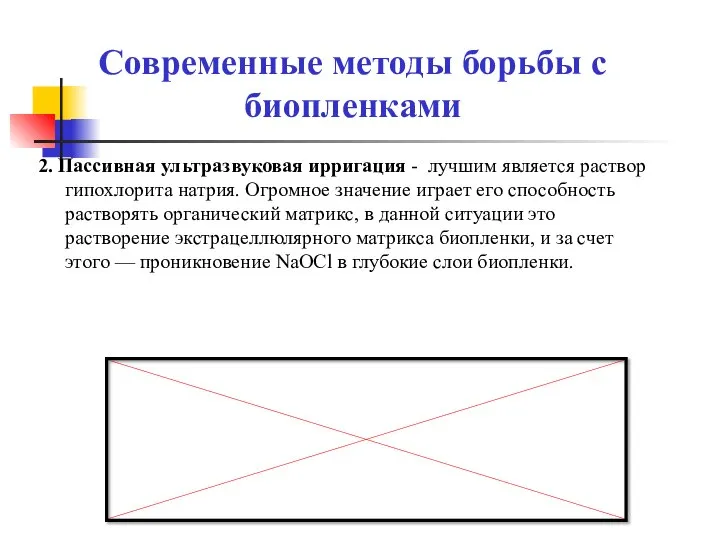 2. Пассивная ультразвуковая ирригация - лучшим является раствор гипохлорита натрия. Огромное