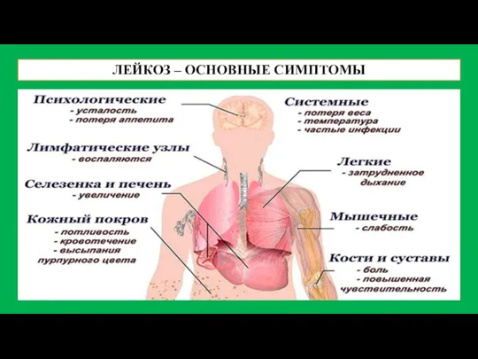 ЛЕЙКОЗ – ОСНОВНЫЕ СИМПТОМЫ