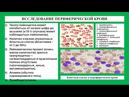 ИССЛЕДОВАНИЕ ПЕРИФЕРИЧЕСКОЙ КРОВИ Число лейкоцитов может колебаться от низких цифр до