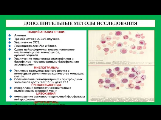 ДОПОЛНИТЕЛЬНЫЕ МЕТОДЫ ИССЛЕДОВАНИЯ ОБЩИЙ АНАЛИЗ КРОВИ: Анемия. Тромбоцитоз в 20-30% случаев.