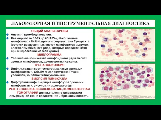 ЛАБОРАТОРНАЯ И ИНСТРУМЕНТАЛЬНАЯ ДИАГНОСТИКА ОБЩИЙ АНАЛИЗ КРОВИ Анемия, тромбоцитопения. Лейкоцитоз от