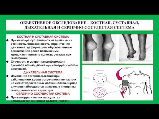 ОБЪЕКТИВНОЕ ОБСЛЕДОВАНИЕ – КОСТНАЯ, СУСТАВНАЯ, ДЫХАТЕЛЬНАЯ И СЕРДЕЧНО-СОСУДИСТАЯ СИСТЕМА КОСТНАЯ И