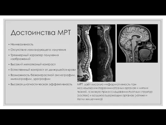 Достоинства МРТ Неинвазивность Отсутствие ионизирующего излучения Трехмерный характер получения изображений Высокий