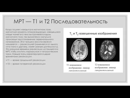 МРТ — Т1 и Т2 Последовательность Когда пациент находится в магнитном