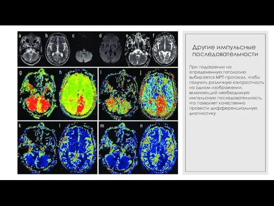 Другие импульсные последовательности При подозрении на определенную патологию выбирается МРТ-протокол, чтобы