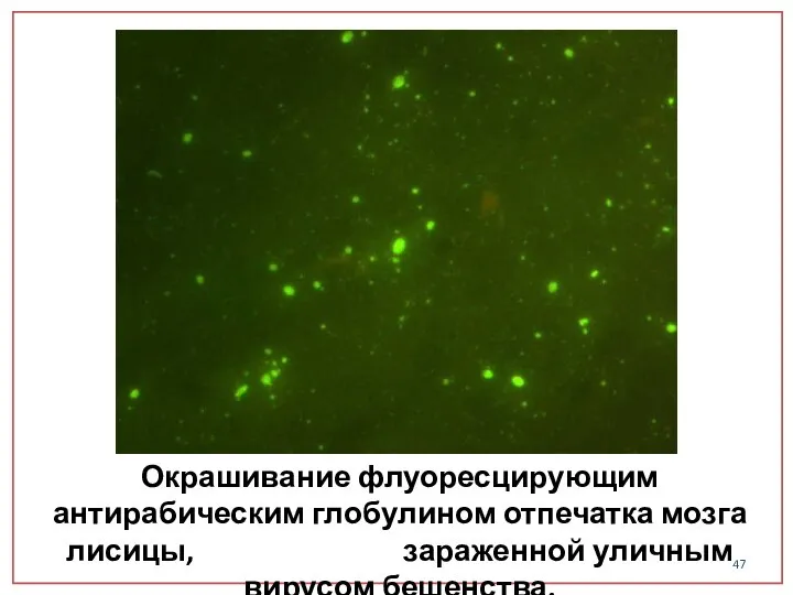 Окрашивание флуоресцирующим антирабическим глобулином отпечатка мозга лисицы, зараженной уличным вирусом бешенства.