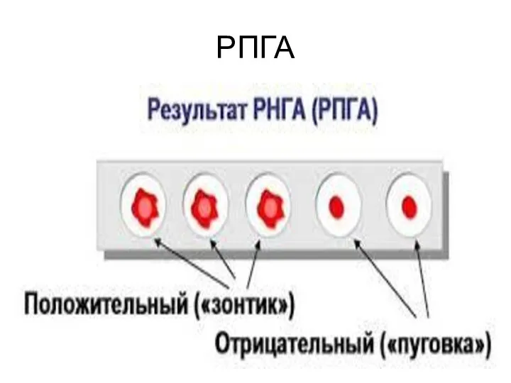 РПГА