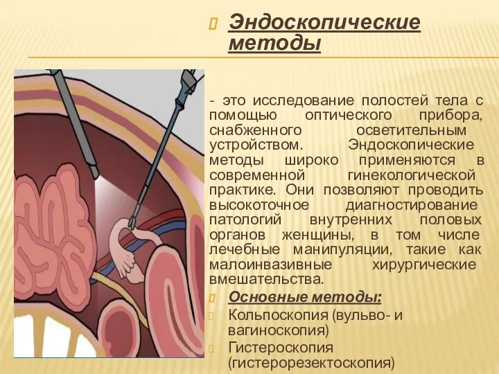 Эндоскопические методы - это исследование полостей тела с помощью оптического прибора,