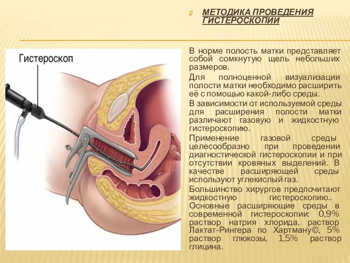 МЕТОДИКА ПРОВЕДЕНИЯ ГИСТЕРОСКОПИИ В норме полость матки представляет собой сомкнутую щель