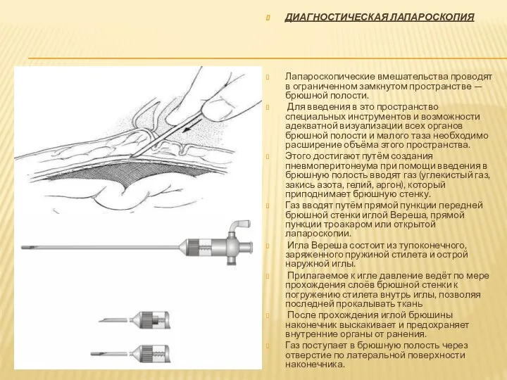 ДИАГНОСТИЧЕСКАЯ ЛАПАРОСКОПИЯ Лапароскопические вмешательства проводят в ограниченном замкнутом пространстве — брюшной