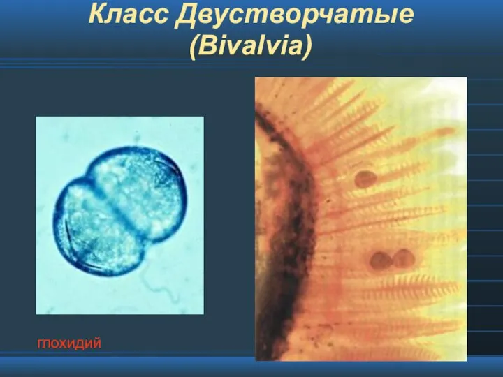 Класс Двустворчатые (Bivalvia) глохидий