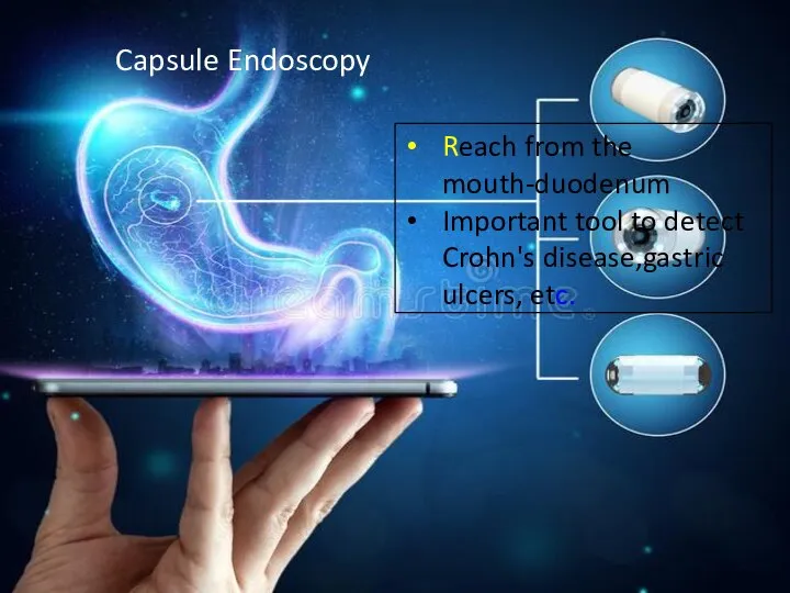 Capsule Endoscopy Reach from the mouth-duodenum Important tool to detect Crohn's disease,gastric ulcers, etc.