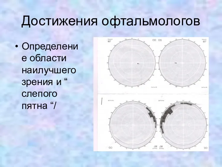 Достижения офтальмологов Определение области наилучшего зрения и “ слепого пятна “/